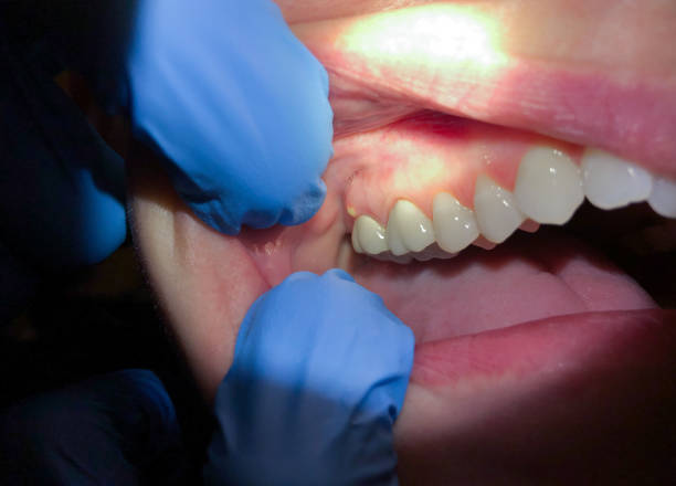 Caledonia, MS Emergency Dentist Pros